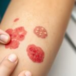 rash identification step guide