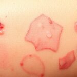 when to seek medical help